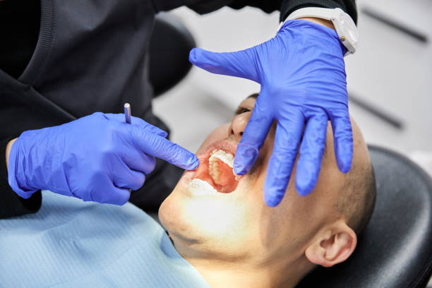 Best Knocked-Out Tooth (Avulsed Tooth) Treatment in Brushy, OK